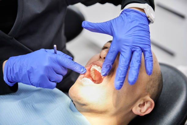 Best Emergency Dental Extractions in Mazon, IL